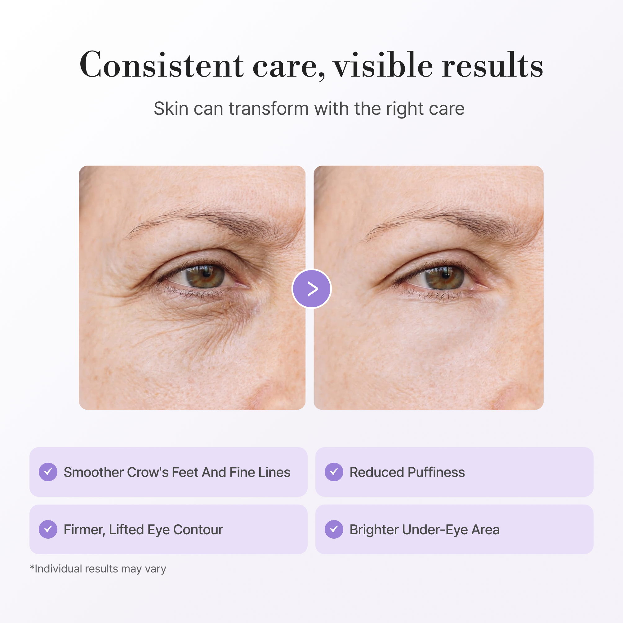 Eye Cream thumbnail 3