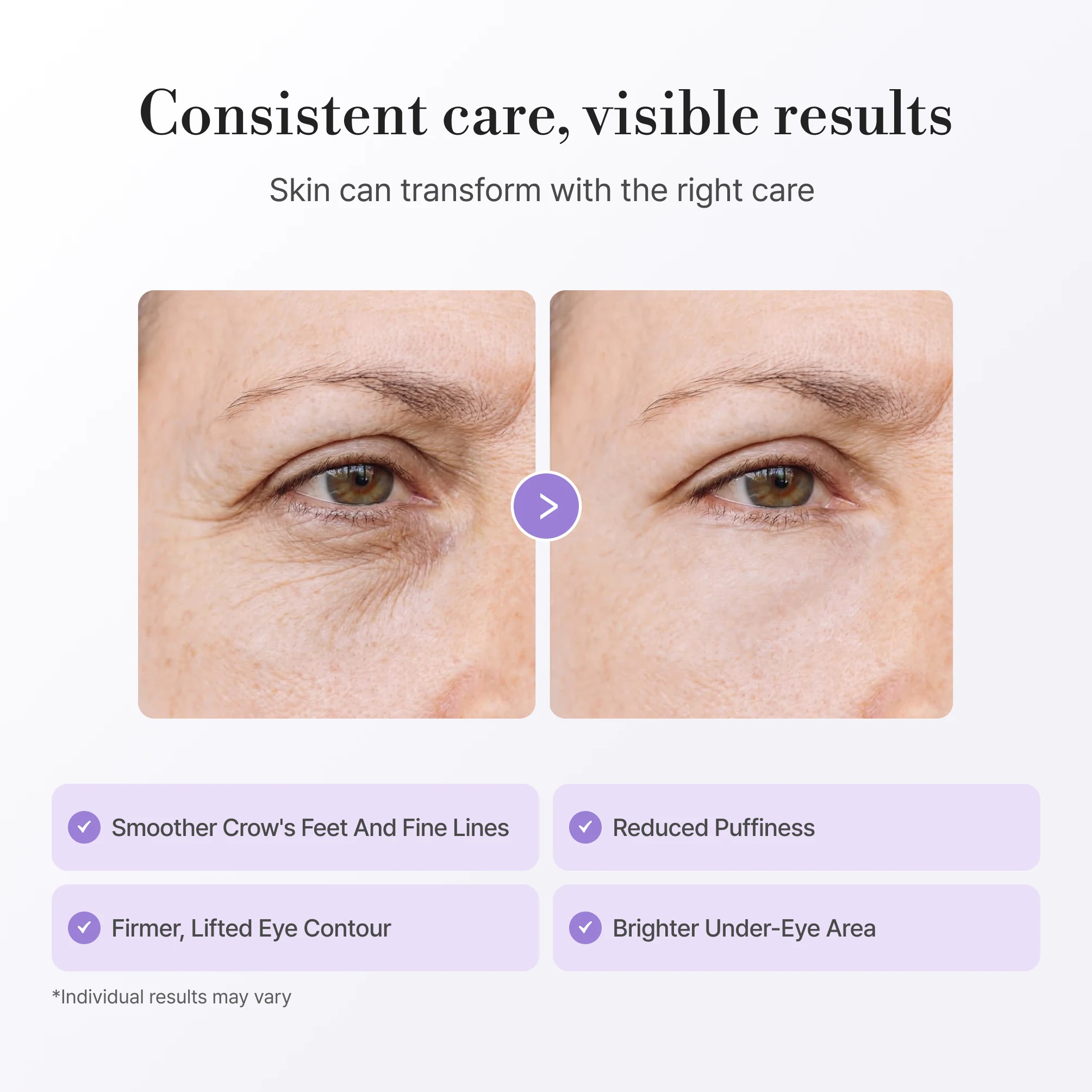 Eye Cream thumbnail 3