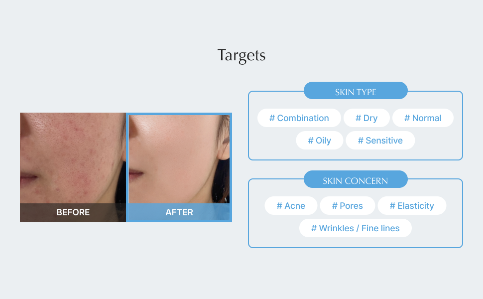 Lepique Retinol Night Cream — Amazon US aplus image 2